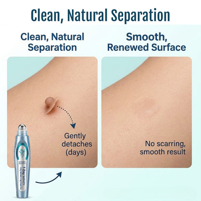 QIAWI® SpotlessPro Advanced Skin Care Pen