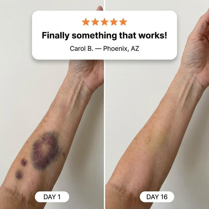 💥💥100K+ SOLD💕- TAILEDEN® Bruise Repair & Skin-Strengthening Cream